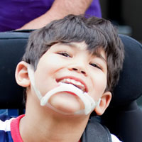 Special Needs Childrens Dentist Burnaby
